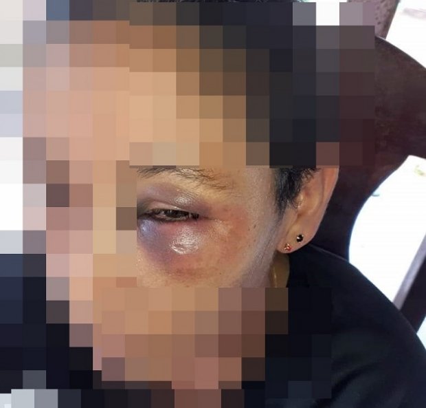 Mulher é espancada e ameaça de morte pela ex namorada e companheira