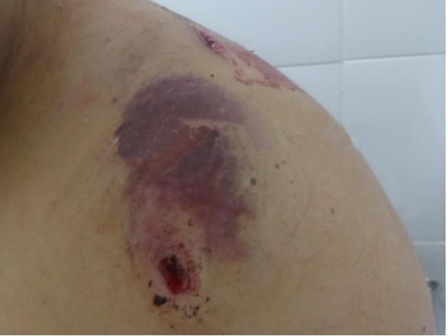 URGENTE: Bandidos atiram em vitimas durante assalto na zona rural de Novo Mundo.