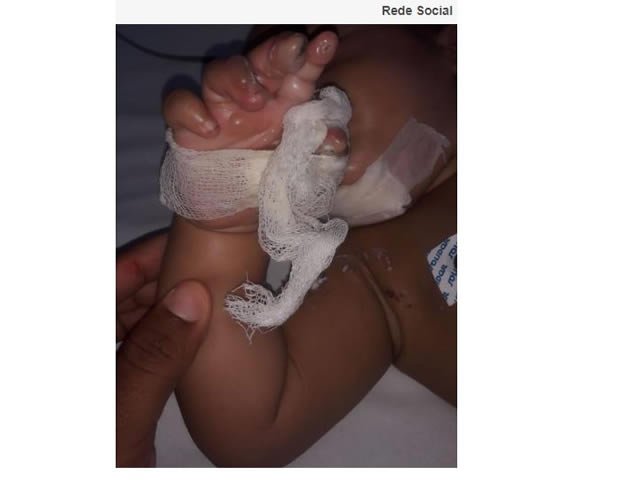 Bebê que levou choque ao pegar em carregador de celular conectado à tomada continua internado