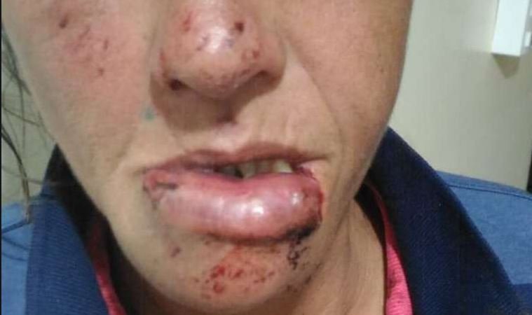 Homem de 40 anos em Colíder fratura mandíbula de menor durante briga numa mercearia.