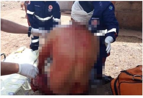 Homem é esfaqueado e atribui crime a membros da facção Comando Vermelho