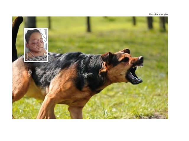 Criança de dois anos desmaia após ser atacada por cachorro de grande porte
