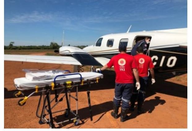 Índio tem queimadura em 60% do corpo e é transferido para Cuiabá. (Fotos)
