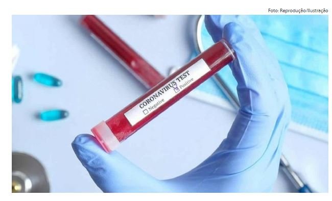 Em 19 horas, Lacen recebe 500 amostras para testes do novo coronavírus; antes eram 70 por dia