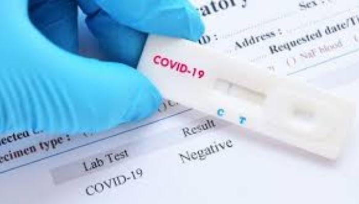 SES registra 130 novos casos e 42 óbitos por Covid-19