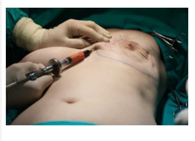 TJ manda plano fazer cirurgias para "afinar voz e implantar seios" numa transexual em MT