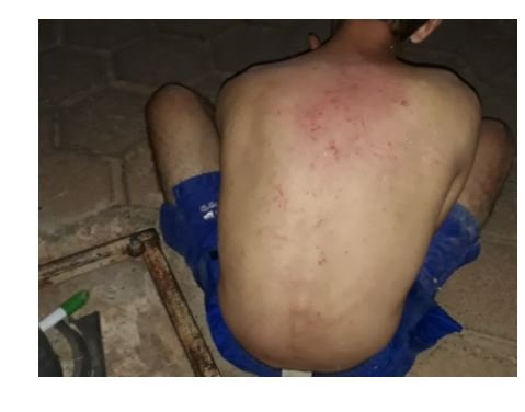 Homem tenta comprar droga fiado e acaba sendo espancado