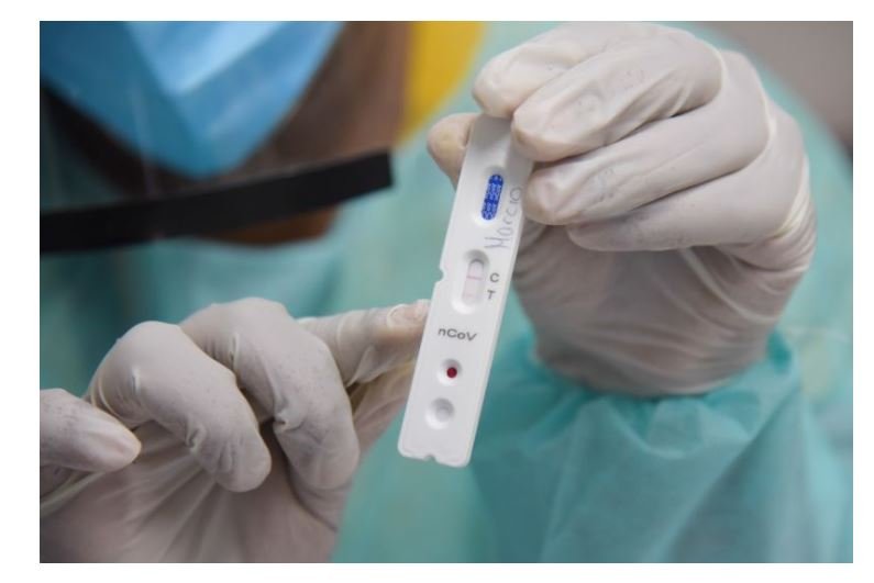 Mato Grosso registra 515 novos casos e 29 mortes por Covid-19 em 24 horas; já são 9.776 infectados e 370 óbitos