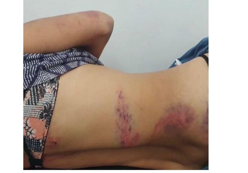 Mulher é sequestrada pelo ex e espancada durante três dias