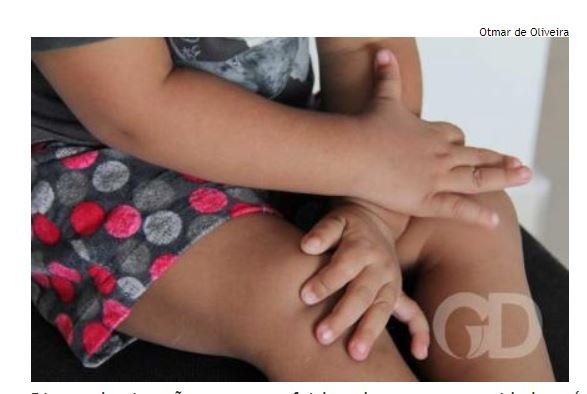 Criança de 1 ano diz que está com bicho na vagina e babá denuncia estupro