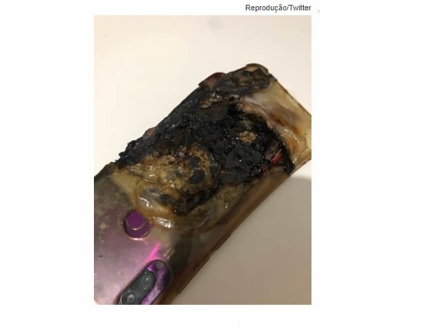 Jovem tem mãos e peito queimados após celular explodir na cama em que ele dormia; veja fotos