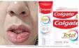 Pasta da Colgate com venda proibida causa reações adversas a mais de 1,2 mil pessoas