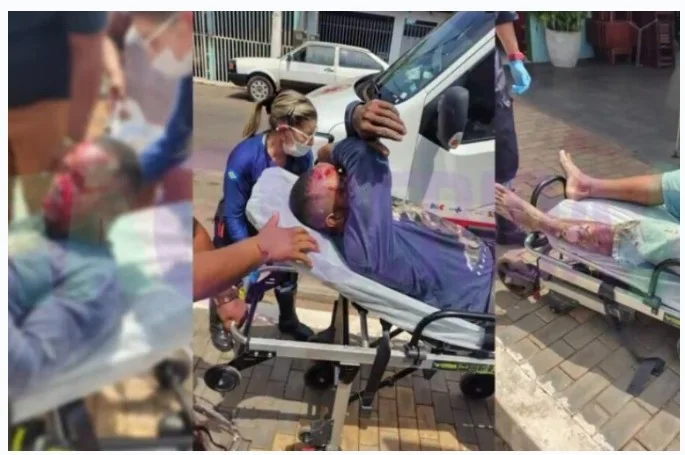 Eletricista sofre forte descarga elétrica e fica com gravíssimos ferimentos em MT; vídeo mostra resgate do SAMU