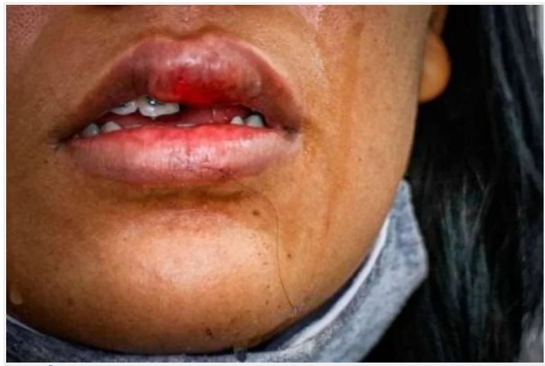 Mulher é agredida após voltar da igreja pelo marido e tem dente quebrado em MT; suspeito fugiu