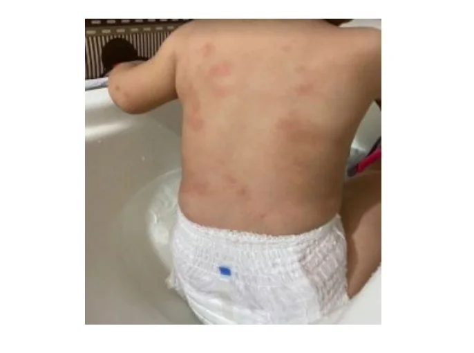 Menino de 2 anos é levado a hospital com ferimentos em MT