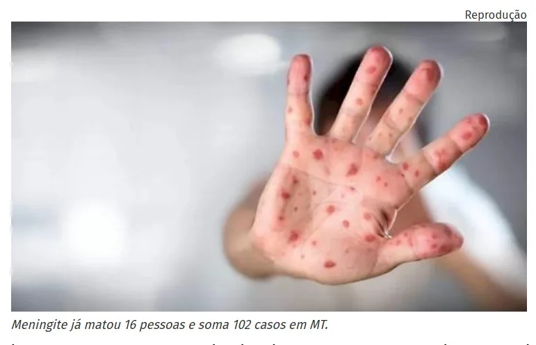 Meningite já matou 16 pessoas e soma 102 casos em MT